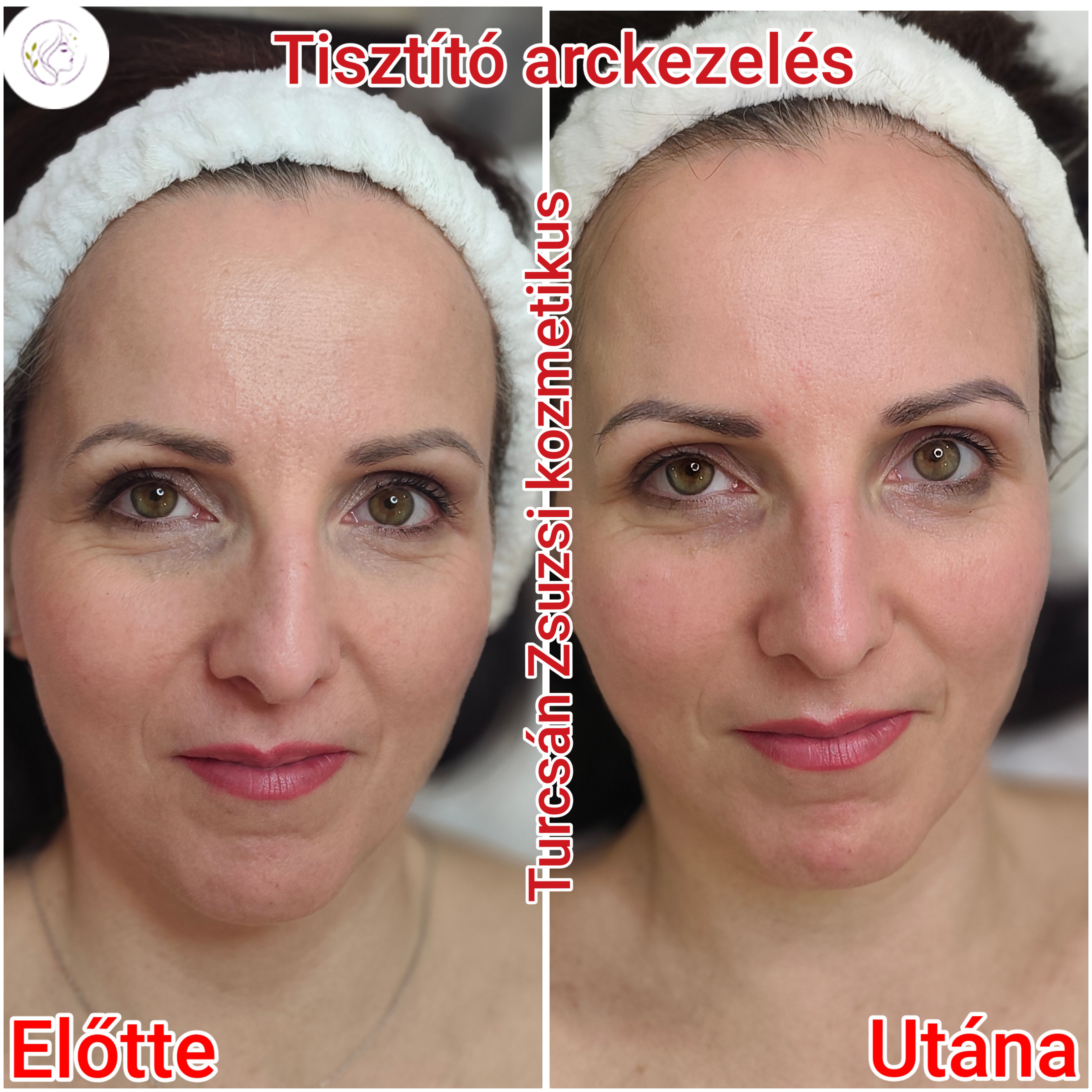Arckezelés eredménye
